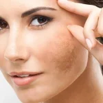 کرم ضد لک دپی وایت ای سی ام 40 میل