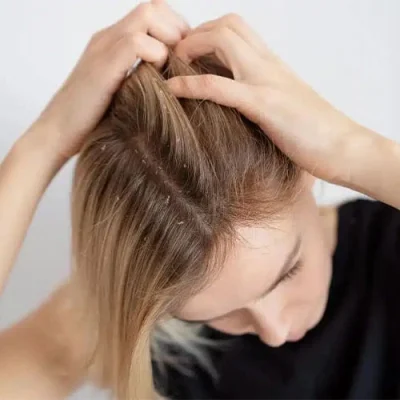 شامپو ضد شوره الپسین مدل DANDRUFF KILLER حجم 250میل