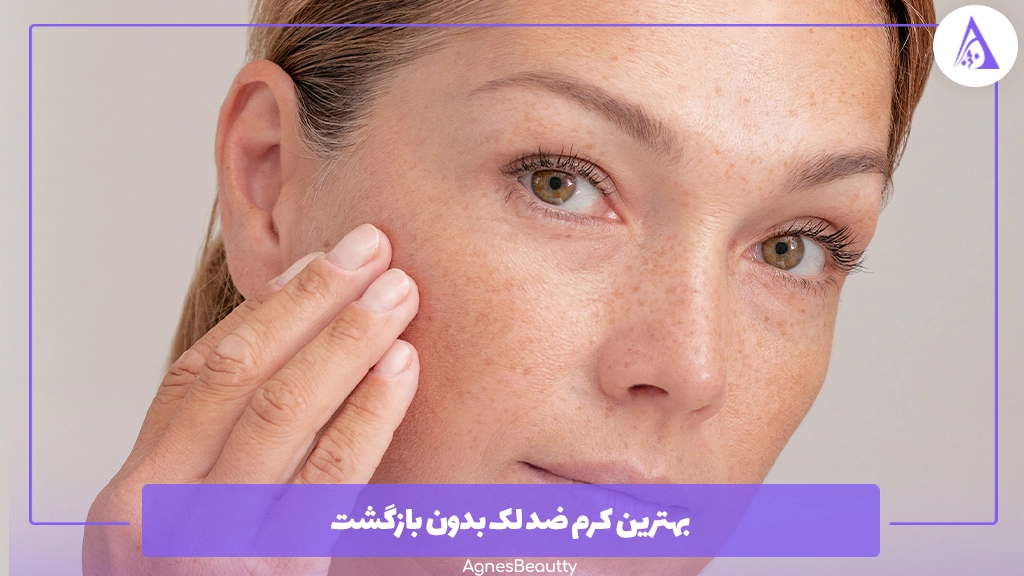 بهترین کرم ضد لک بدون بازگشت