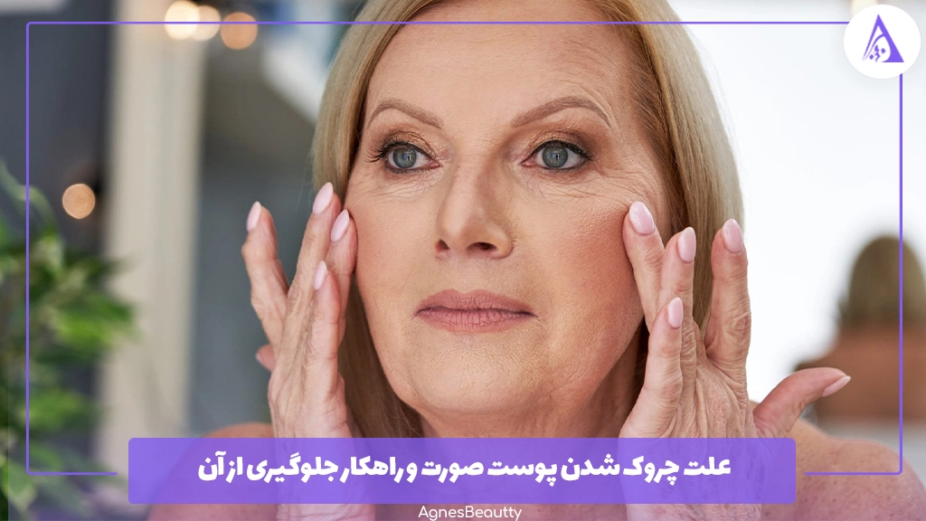 علت چروک شدن پوست صورت و راهکار جلوگیری از آن