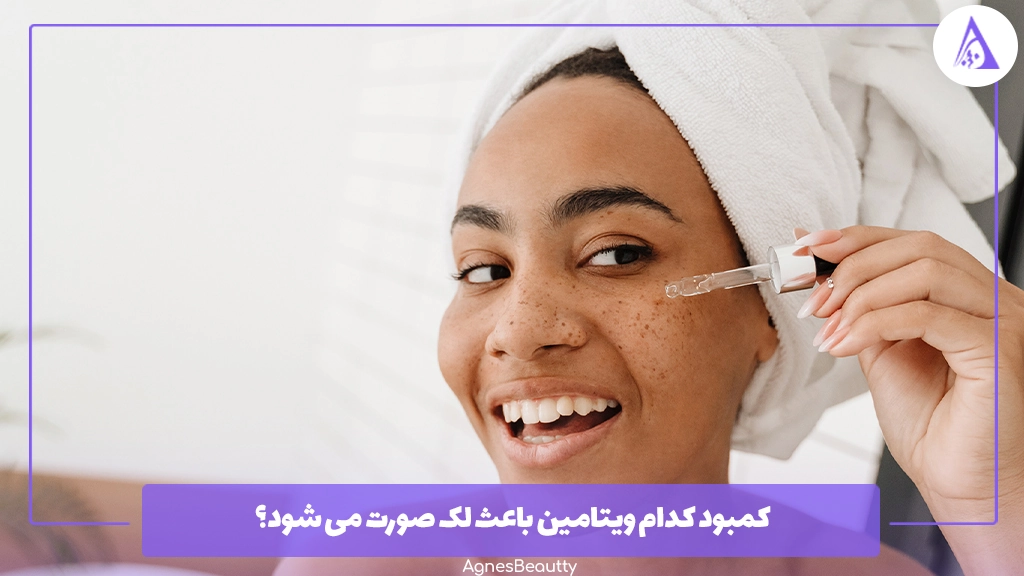 کمبود کدام ویتامین باعث لک صورت می شود؟