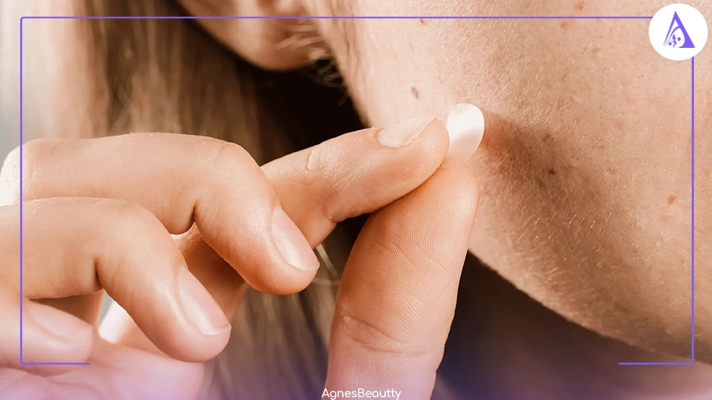 کمبود کدام ویتامین باعث لک صورت می شود؟