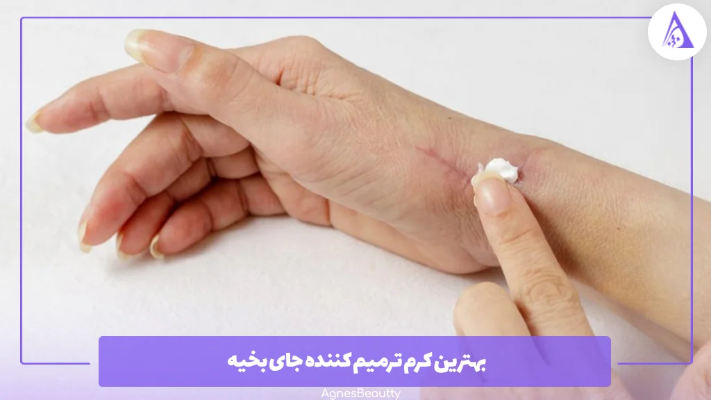 بهترین کرم ترمیم کننده جای بخیه