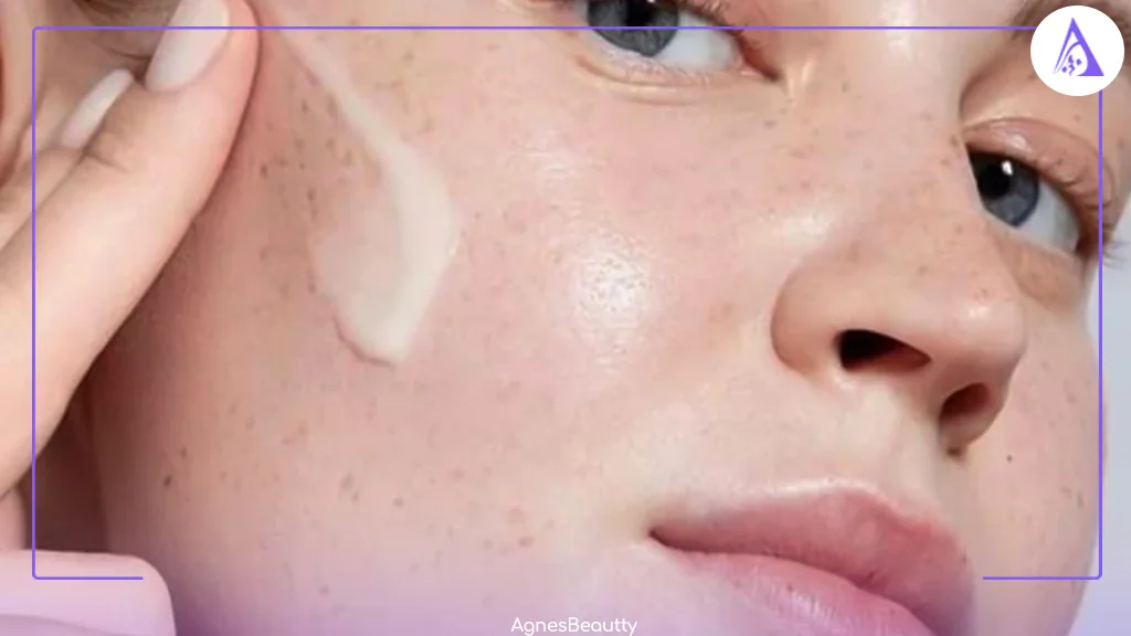 تاثیر کرم آبرسان بر رفع لک پوست صورت