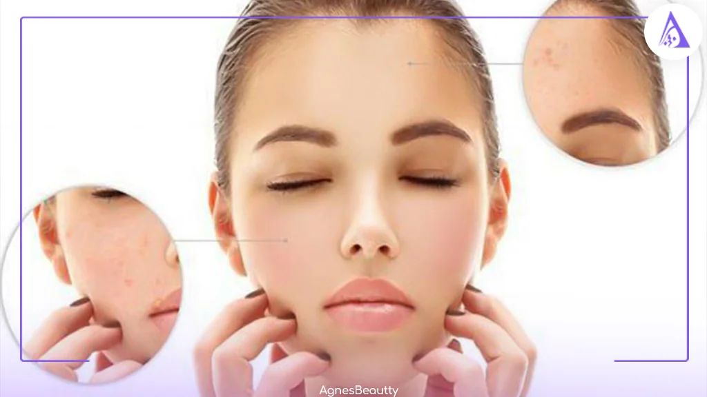 بررسی انواع سرم پوست موجود در بازار