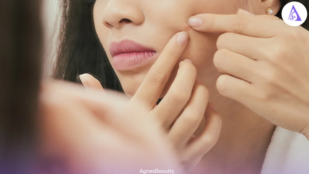 رژیم غذایی و تأثیر آن بر جوش و آکنه