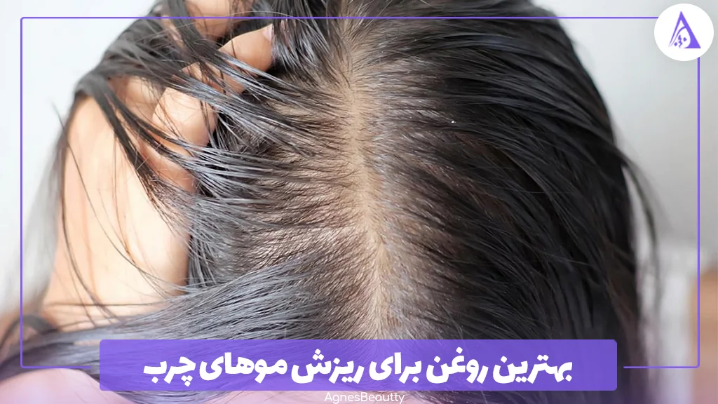 بهترین روغن برای ریزش موهای چرب