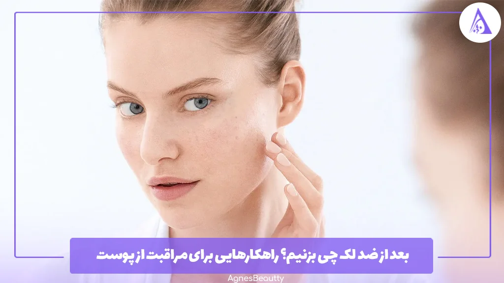 بعد از ضد لک چی بزنیم؟ راهکارهایی برای مراقبت از پوست