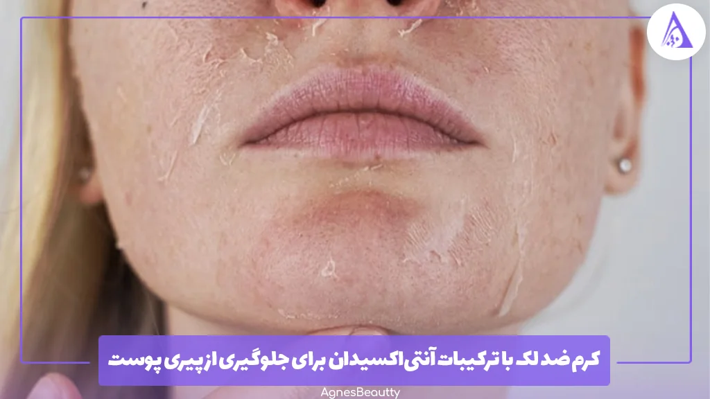 کرم ضد لک با ترکیبات آنتی‌اکسیدان برای جلوگیری از پیری پوست 