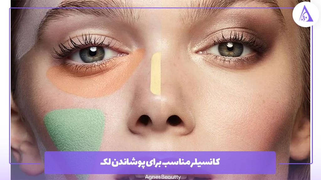 کانسیلر مناسب برای پوشاندن لک 