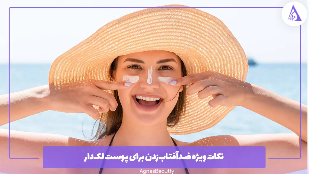 نکات ویژه ضدآفتاب‌زدن برای پوست لک‌دار 