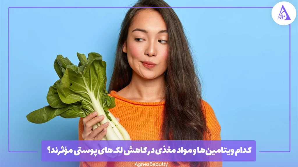 کدام ویتامین‌ها و مواد مغذی در کاهش لک‌های پوستی مؤثرند؟