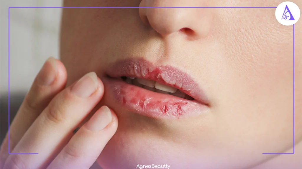 چگونه لب‌های خشک را قبل از رژلب نرم کنیم؟