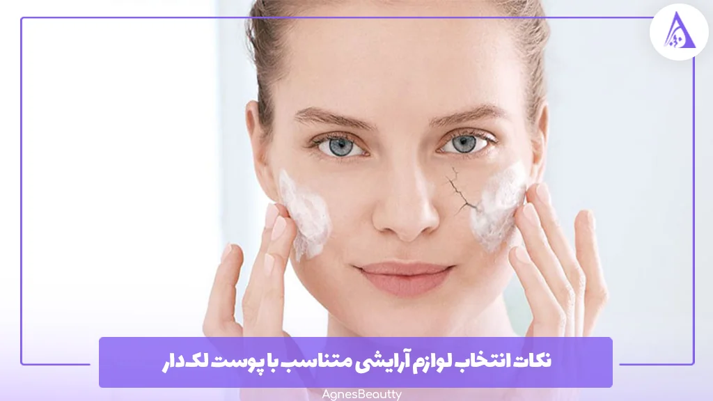 نکات انتخاب لوازم آرایشی متناسب با پوست لک‌دار