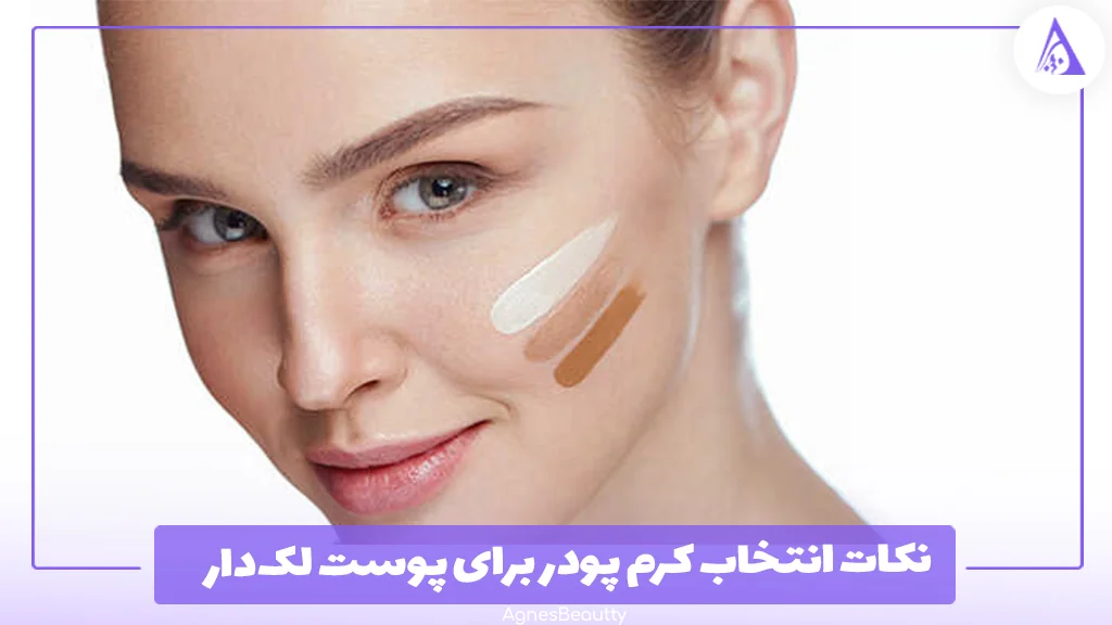 نکات انتخاب کرم پودر برای پوست لک‌دار