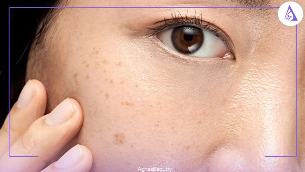 چه راهکارهای برای جلوگیری از ایجاد لکه زیر ماسک وجود دارد؟