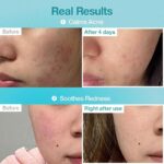 ماسک ورقه ای نامبوزین شماره 1 آبرسان و تسکین دهنده Numbuzin No.1 Pantothenic B5 Hyaluronic Active Clear Mask