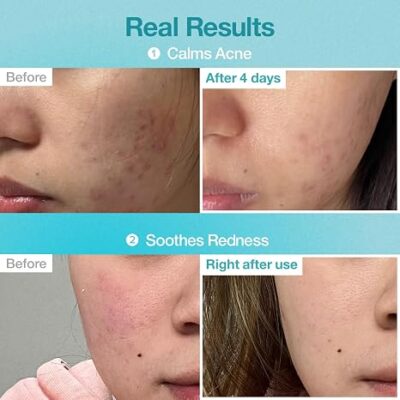 ماسک ورقه ای نامبوزین شماره 1 آبرسان و تسکین دهنده Numbuzin No.1 Pantothenic B5 Hyaluronic Active Clear Mask